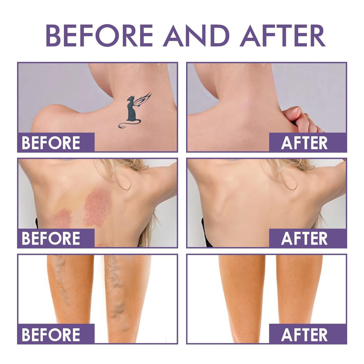 💜✨Body Coverage Perfector – Vandtæt, Letvægts &  Fejlfri kropsmakeup