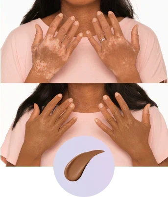 💜✨Body Coverage Perfector – Vandtæt, Letvægts &  Fejlfri kropsmakeup